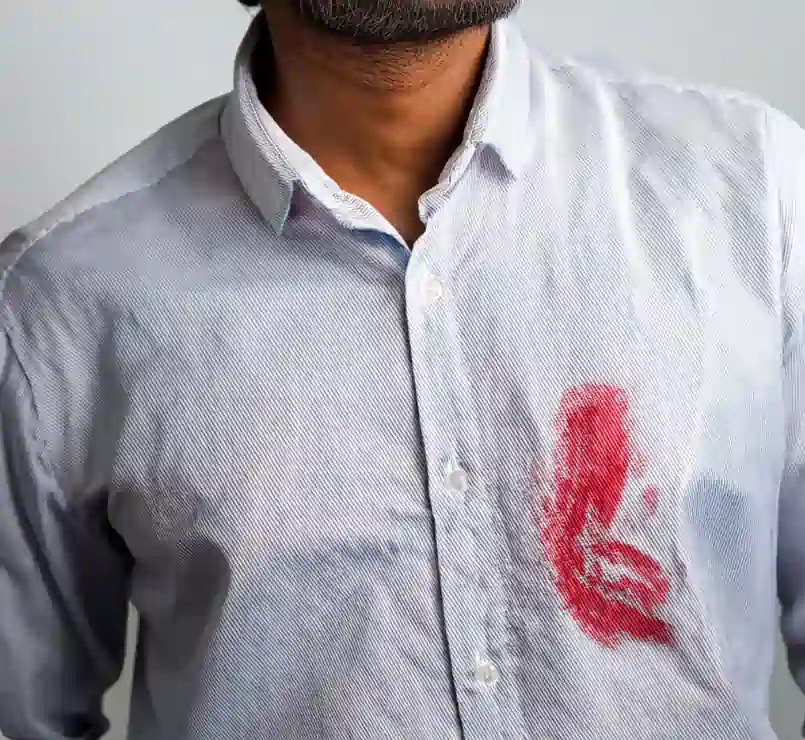 Dried Lip gloss stain on shirt